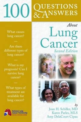 100 Questions & Answers About Lung Cancer -  Parles