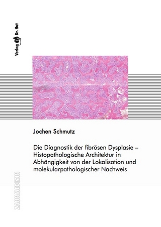 Die Diagnostik der fibrösen Dysplasie – Histopathologische Architektur in Abhängigkeit von der Lokalisation und molekularpathologischer Nachweis