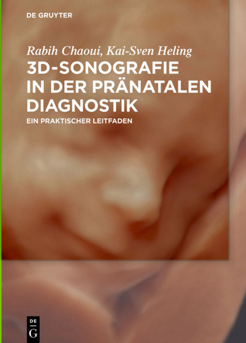 3D-Sonografie in der pr&auml;natalen Diagnostik - Rabih Chaoui, Kai-Sven Heling