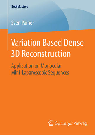 Variation Based Dense 3D Reconstruction
