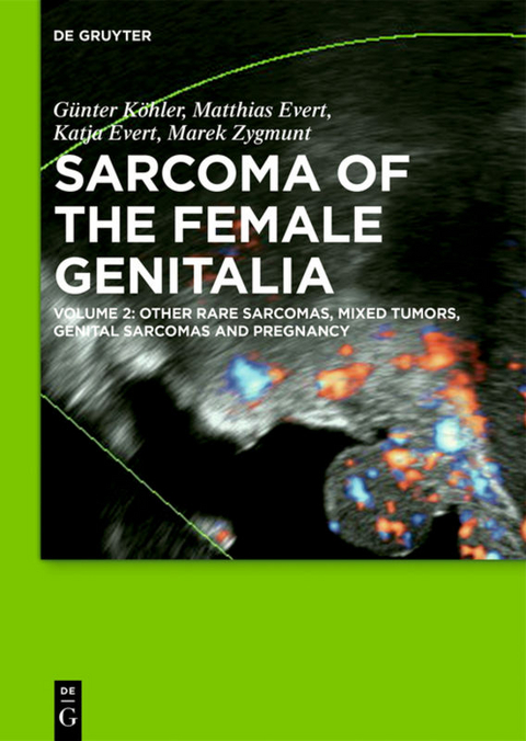 Sarcoma of the Female Genitalia - G&uuml;nter K&ouml;hler, Matthias Evert, Katja Evert, Marek Zygmunt