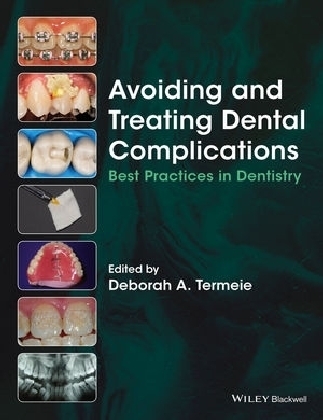 Avoiding and Treating Dental Complications - 