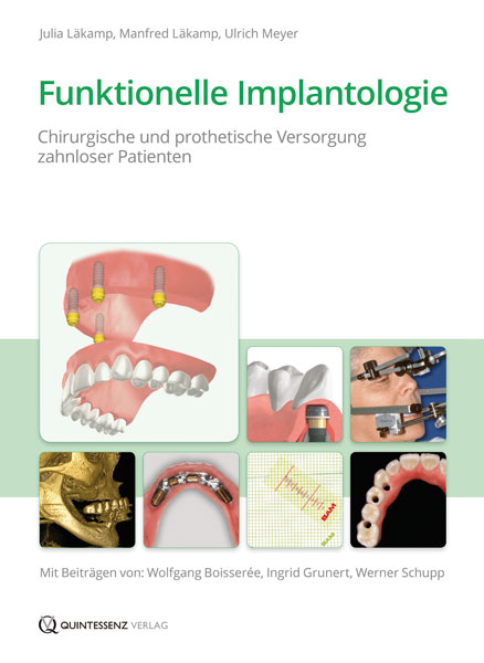 Funktionelle Implantologie bei Zahnlosen - Julia Läkamp, Manfred Läkamp, Ulrich Meyer