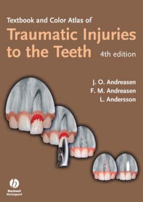 Textbook and Color Atlas of Traumatic Injuries to the Teeth 4E - 