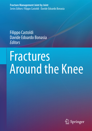 Fractures Around the Knee
