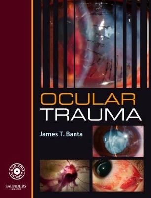 Ocular Trauma