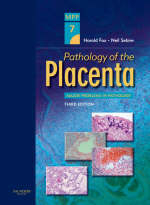 Pathology of the Placenta