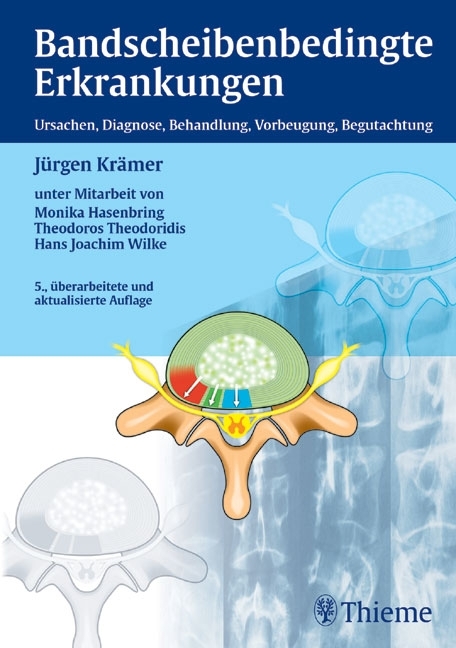 Bandscheibenbedingte Erkrankungen - 