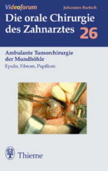 Ambulante Tumorchirurgie der Mundhöhle