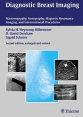 Diagnostic Breast Imaging - Sylvia H. Heywang-K&ouml;brunner, D. David Dershaw, Ingrid Schreer