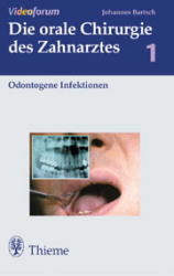Odontogene Infektionen