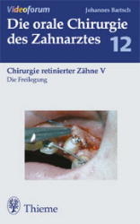 Die Freilegung - Johannes K. Bartsch