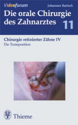 Die Transposition - Johannes K. Bartsch