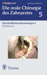 Der retinierte Weisheitszahn - Johannes K. Bartsch