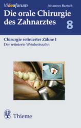 Kieferh&ouml;hlenzyste - Johannes K. Bartsch