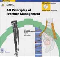 AO Principles of Fracture Management - 