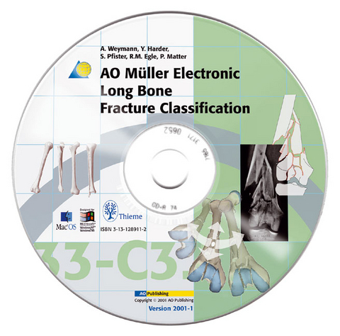 AO M&uuml;ller Electronic Long Bone Fracture Classification, CD-ROM