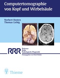 Computertomographie von Kopf und Wirbels&auml;ule - Norbert Hosten, Thomas Liebig