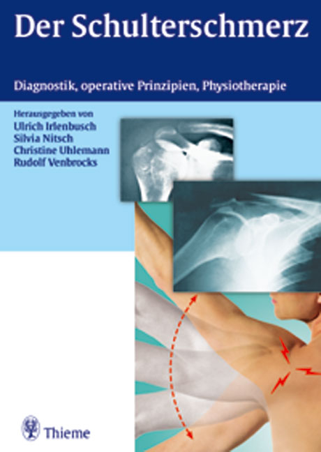 Der Schulterschmerz - 