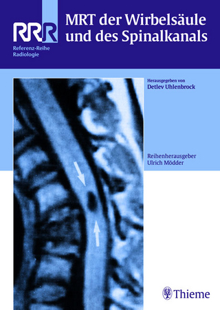 MRT der Wirbelsäule und des Spinalkanals