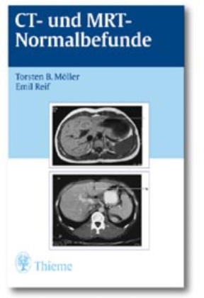 CT und MRT Normalbefunde - Torsten Bert M&ouml;ller, Emil Reif