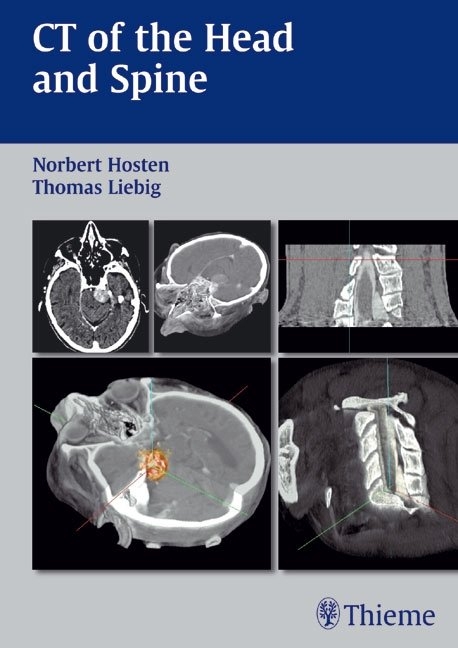 CT of the Head and Spine - Norbert Hosten, Thomas Liebig