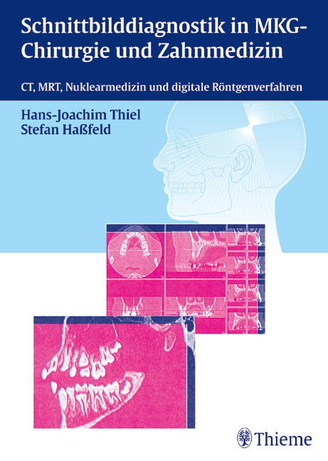 Schnittbilddiagnostik in der zahnärztlichen Radiologie - Hans J Thiel, Stefan Hassfeld
