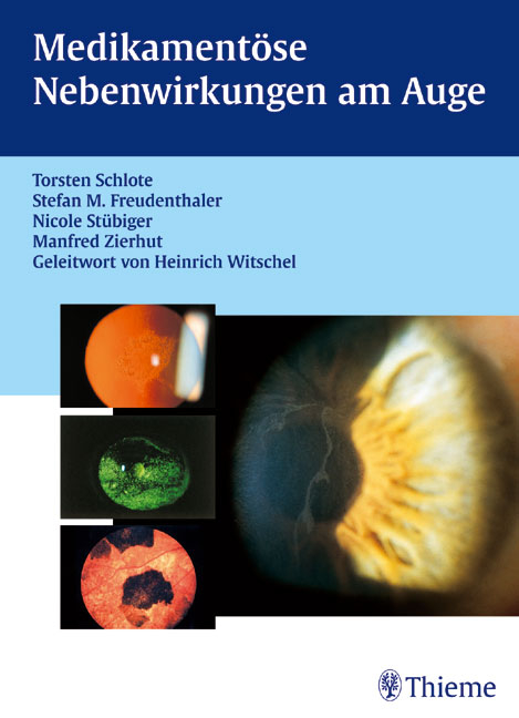 Medikament&ouml;se Nebenwirkungen am Auge - Torsten Schlote, Stefan M Freudenthaler, Nicole St&uuml;biger