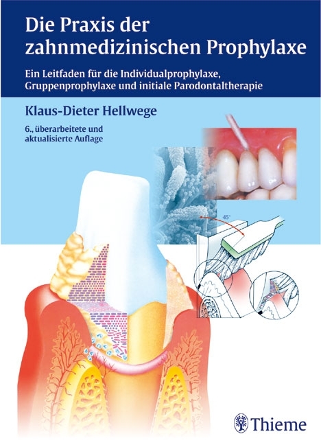 Die Praxis der zahnmedizinischen Prophylaxe - Klaus-Dieter Hellwege
