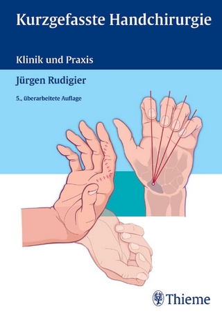 Kurzgefasste Handchirurgie