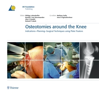 Osteotomies Around the Knee - Philipp Lobenhoffer, Ronald J. van Heerwaarden, Alex E. Staubli, Roland P. Jakob