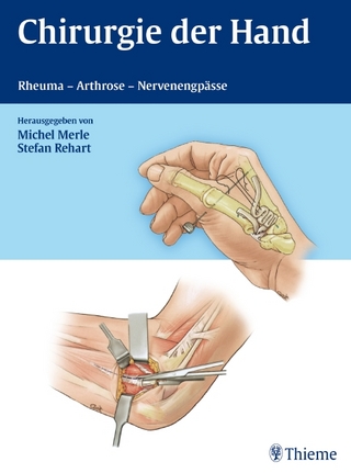 Chirurgie der Hand - Rheuma - Arthrose - Nervenengpässe