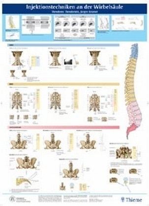 Injektionstherapie an der Wirbels&auml;ule - POSTER - Theodoros Theodoridis, J&uuml;rgen Kr&auml;mer