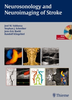 Neurosonology and Neuroimaging of Stroke - Jos&eacute; Manuel Valdueza, Stephan Schreiber, Jens-Eric R&ouml;hl, Randolf Klingebiel
