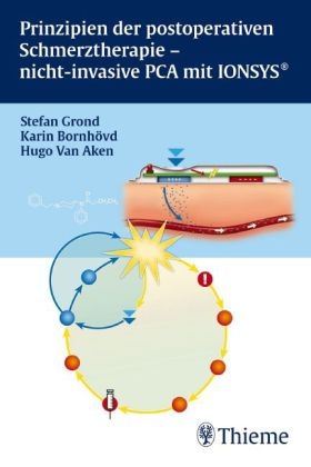 Prinzipien der postoperativen Schmerztherapie - nicht-invasive PCA mit IONSYS®