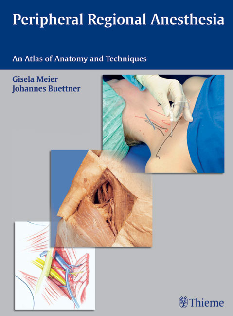 Peripheral Regional Anesthesia - Gisela Meier, Johannes Buettner, Johannes B&uuml;ttner