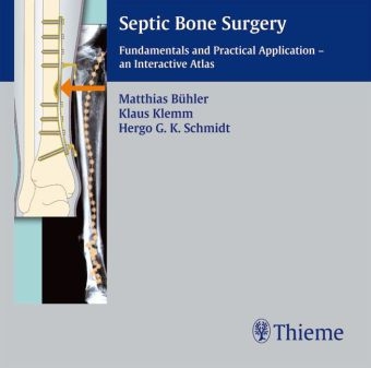 Septic Bone Surgery - Matthias B&uuml;hler, Klaus Klemm, Hergo G K Schmidt