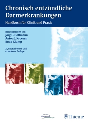 Chronisch entz&uuml;ndliche Darmerkrankungen - J&ouml;rg C. Hoffmann, Anton J. Kroesen, Bodo Klump