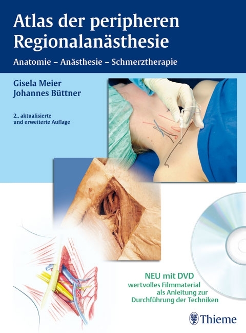 Atlas der peripheren Regionalan&auml;sthesie - Gisela Meier, Johannes B&uuml;ttner