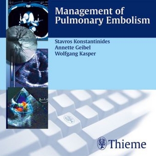 Management of Pulmonary Embolism