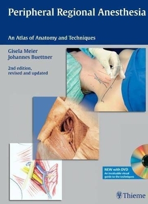 Peripheral Regional Anesthesia - Gisela Meier, Johannes Buettner, Johannes B&uuml;ttner