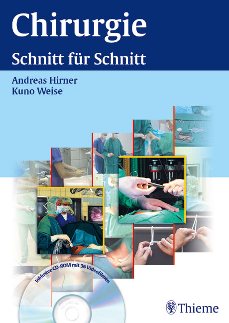 Chirurgie. "Schnitt f&uuml;r Schnitt" - 