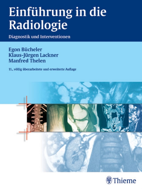 Einf&uuml;hrung in die Radiologie - Egon B&uuml;cheler, Klaus-J&uuml;rgen Lackner, Manfred Thelen