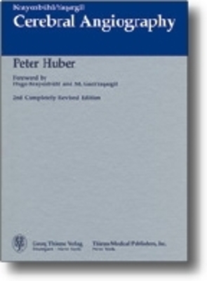 Cerebral Angiography