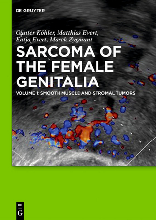 Sarcoma of the Female Genitalia
