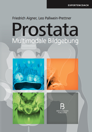 Prostata