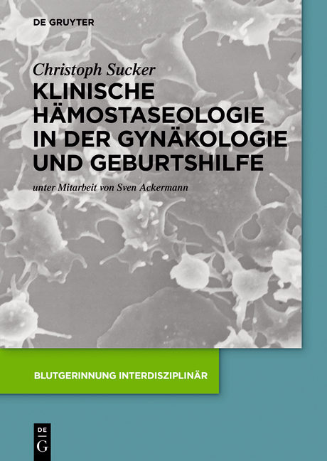Klinische H&auml;mostaseologie in der Gyn&auml;kologie und Geburtshilfe - Christoph Sucker