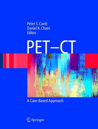 Pet-Ct