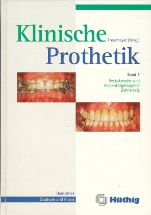 Klinische Prothetik - 