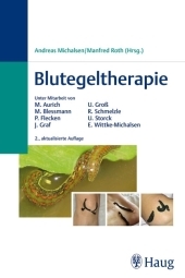 Blutegeltherapie - 